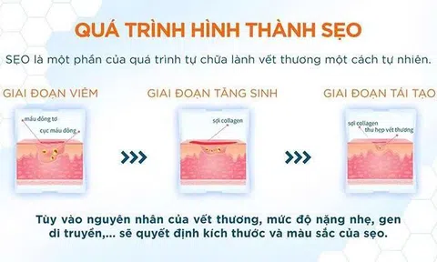 Giải mã vì sao trị sẹo sớm giúp tiết kiệm thời gian và chi phí