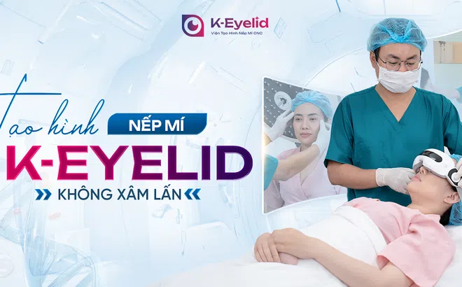 Tạo Hình Mí Mắt Không Xâm Lấn K-Eyelid – Lựa Chọn Làm Đẹp Mới Của Phái Đẹp Thông Minh